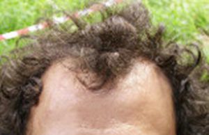 Addio al maestro Daniele Comincioli: sei anni di agonia dopo l’incidente