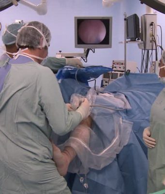 Muore 9 mesi dopo l’intervento di liposuzione: indaga la Procura