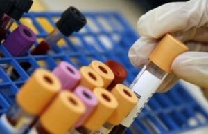 Allarme Legionella al centro sportivo di Erbusco