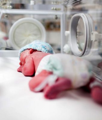 “Enterocolite necrotizzante”: questa la causa della morte di 2 dei 4 neonati