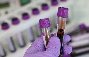 Coronavirus, Regione Lombardia, ok ai test privati