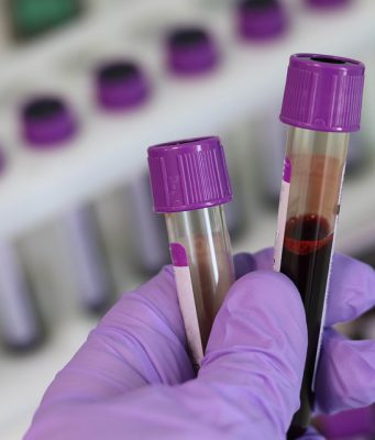 Oltre 7mila test sierologici nei primi due giorni, 5mila a Brescia