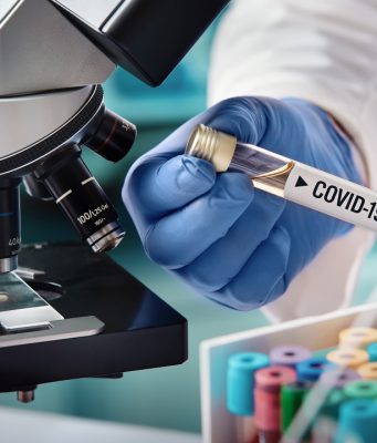 Lombardia, si abbassa l’indice Rt: ora il Covid-19 è meno contagioso