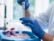 La “variante inglese” del Covid-19 è in Lombardia, due casi a Pavia e uno a Varese