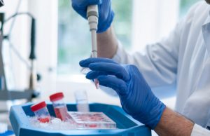 Allerta terapia intensiva in 10 regioni. Tra queste c’è anche la Lombardia