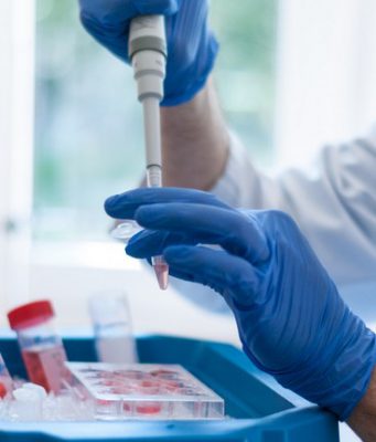 Covid-19, l’indice Rt in Lombardia sale all’ 1,14