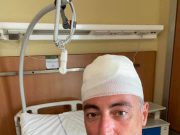 Gallera, sbatte la testa giocando a paddle. 30 punti di sutura