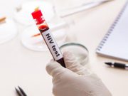Hiv: calano le diagnosi, ma ci si testa troppo tardi