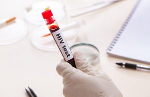 Hiv: calano le diagnosi, ma ci si testa troppo tardi