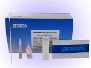 Tamponi fai da te? Fra poche settimane potremmo trovare il kit al supermercato