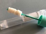 Parte da Travagliato la sperimentazione dei test salivari