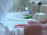 Vaiolo delle scimmie: nessun nuovo caso a Brescia