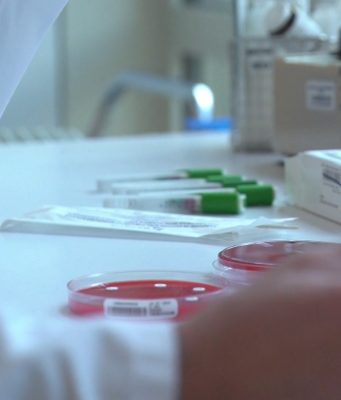 Vaiolo delle scimmie: 252 casi in Lombardia, a giorni il vaccino