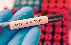 Test gratis per l’epatite, nel bresciano oltre 3.300 prelievi