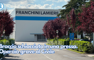 Braccio schiacciato in una pressa. Operaio grave al Civile