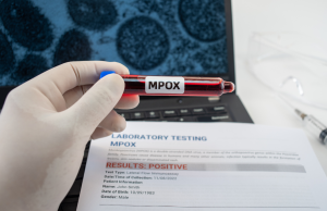 Vaiolo delle scimmie, Bertolaso: “Nessun caso con variante tipo I”