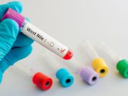 12 casi di West Nile in Lombardia, “in linea con gli scorsi anni”