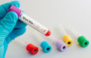 12 casi di West Nile in Lombardia, “in linea con gli scorsi anni”